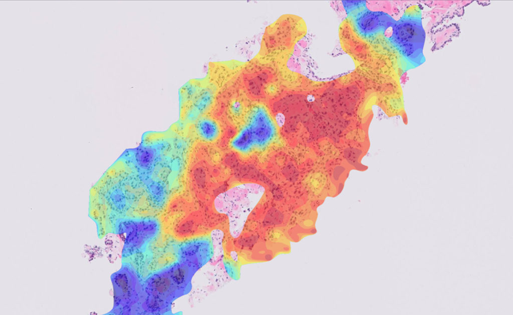 AI based digital pathology scan for primary diagnosis.