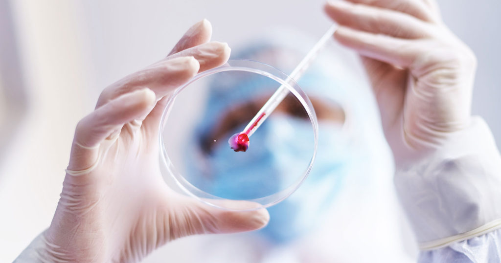 A close up of a scientist depositing a blood sample in a petri dish.