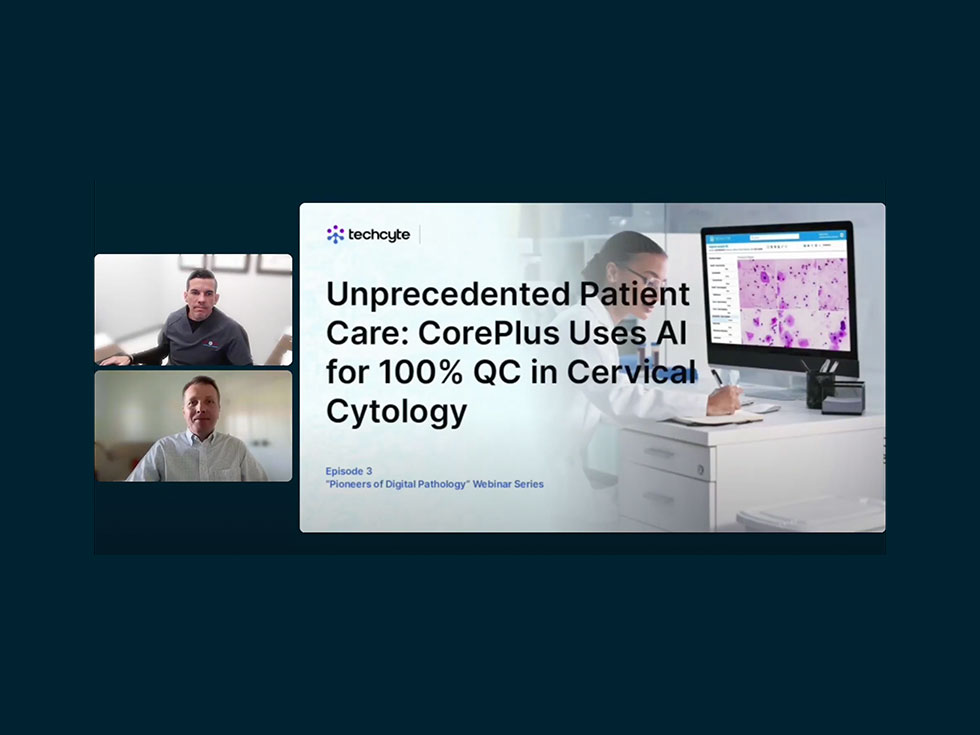 A screenshot of the webinar titled "Unprecedented Patient Care: CorePlus Uses AI for 100% QC in Cervical Cytology.